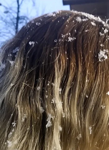 Снежинки на волосах